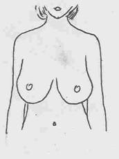 Pre-operatorio